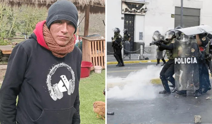 Cusco: víctima de represión policial es dado de alta y aún tiene 5 perdigones en el cuerpo